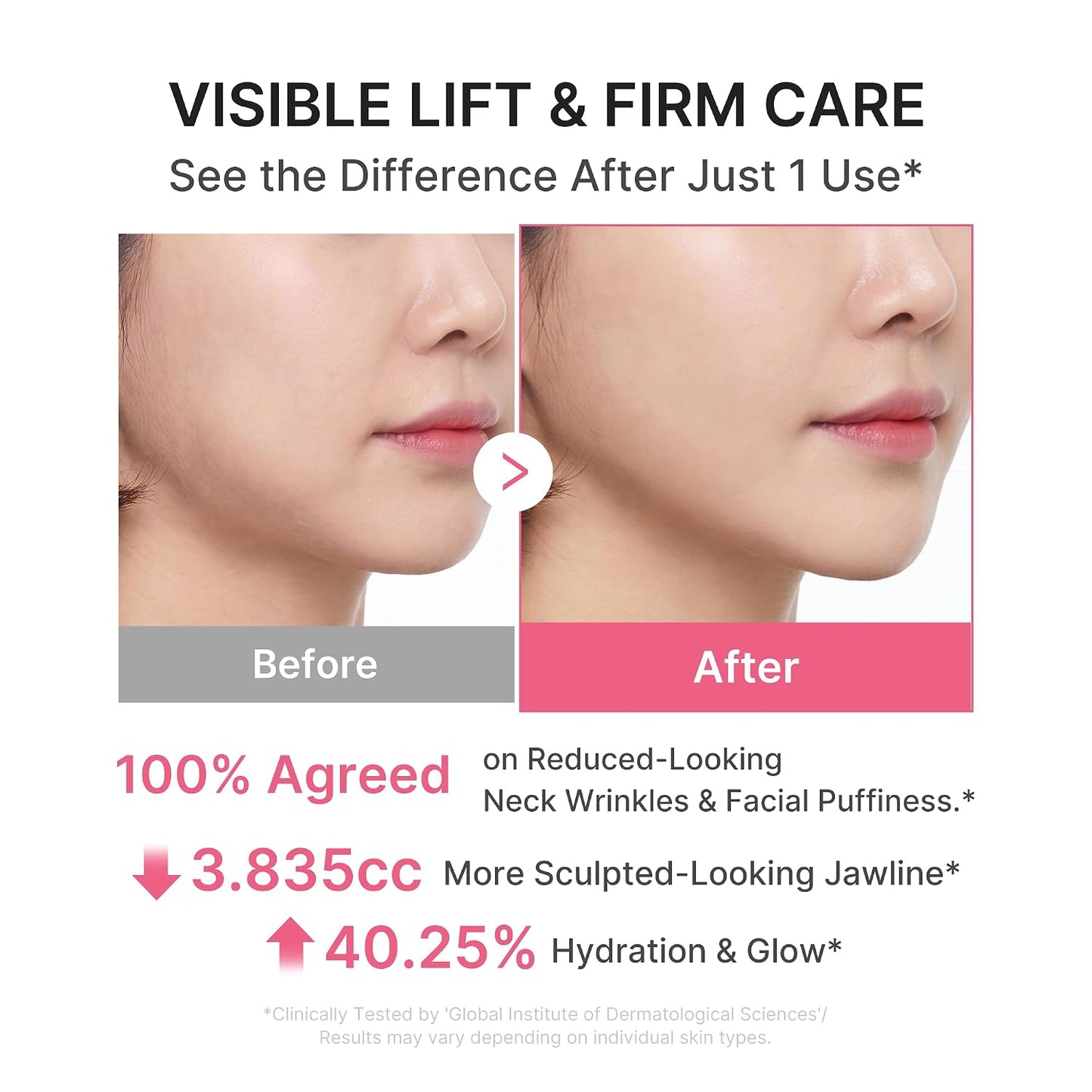 [NEW] [medicube] PDRN Collagen Gua Sha Neck Wrinkle Cream | Built-In Gua Sha Massager with Volufiline 5% + PDRN | Firming, Contour Care for the Look of Fine Lines, Jawline, Neck, Décolleté | Massage Cream | Korean Skincare