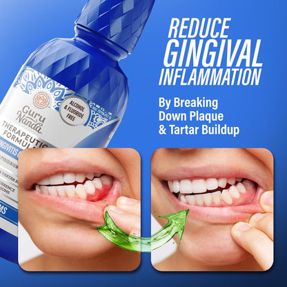 GuruNanda Healthy Gums Mouthwash for Gingivitis & Bleeding Gums – Antigingivitis Oral Rinse with 0.05% CPC – Alcohol-Free, Fluoride-Free Plaque Control – Wild Mint, 16 oz