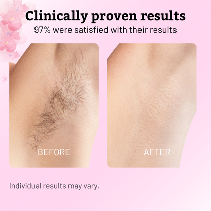 Caramela Beauty Cyperus Rotundus Oil for Natural Permanent Hair Reduction-Shop