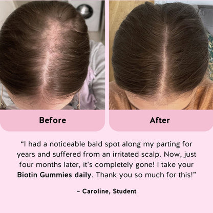 Ah-Mazing Hair Vitamins
