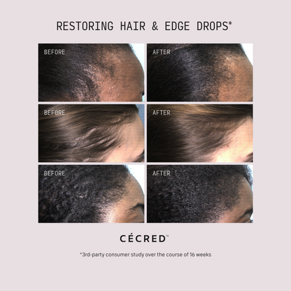 Restoring Hair & Edge Drops
