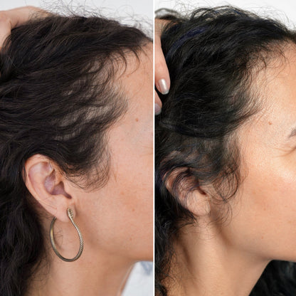 Restoring Hair & Edge Drops
