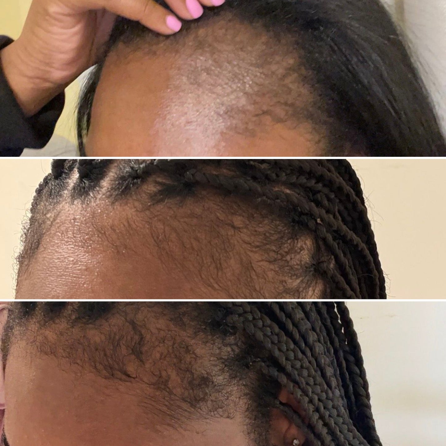 Restoring Hair & Edge Drops