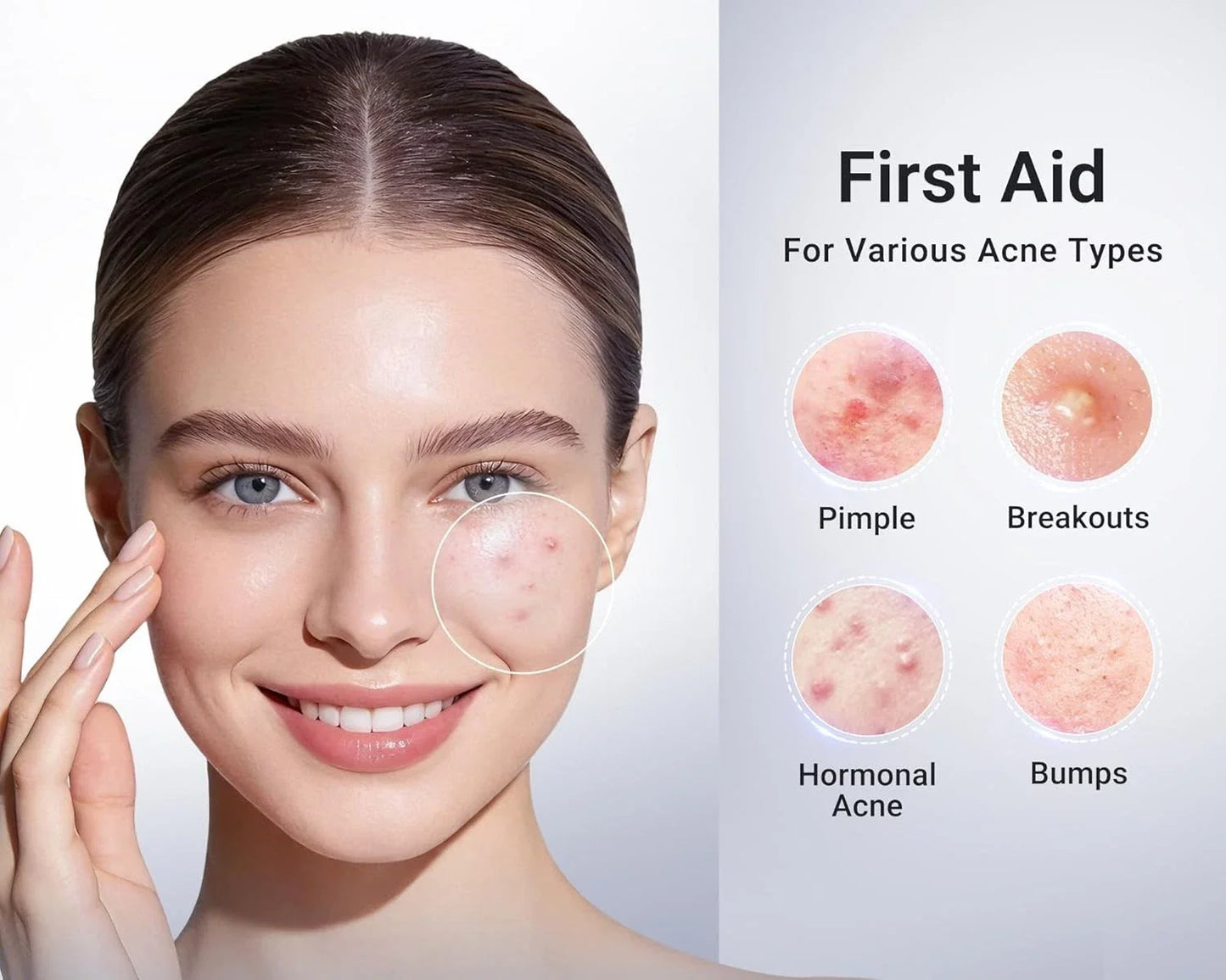 Dr. Leo 1.8% Salicylic Acid Drying Lotion – Acne Treatment for Face, 0.34 fl oz